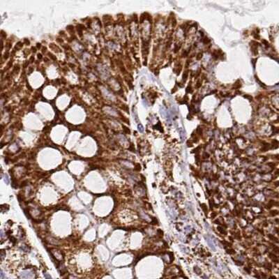 Immunohistochemistry-Paraffin: ATP5A Antibody [NBP2-38525] - Staining of human colon.