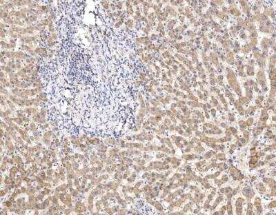 Immunohistochemistry-Paraffin: ATP5A Antibody [NBP3-12789] -  Staining of human ATP5A1 in human liver with rabbit polyclonal antibody at 1:100 dilution.