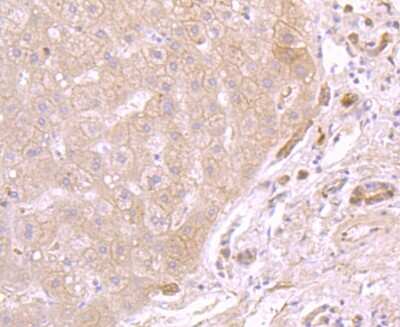 Immunohistochemistry-Paraffin: ATP5A Antibody (JM110-04) [NBP2-67170] - Analysis of paraffin-embedded human liver tissue using anti-ATP5A1 antibody. Counter stained with hematoxylin.