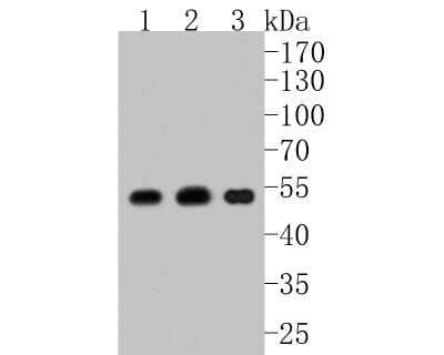 Western Blot: ATP5A Antibody (JM110-04) [NBP2-67170] - Western blot analysis of ATP5A on different lysates. Proteins were transferred to a PVDF membrane and blocked with 5% BSA in PBS for 1 hour at room temperature. The primary antibody (1/500) was used in 5% BSA at room temperature for 2 hours. Goat Anti-Rabbit IgG - HRP Secondary Antibody (HA1001) at 1:5,000 dilution was used for 1 hour at room temperature. Positive control: Lane 1: SKOV-3 cell lysate Lane 2: mouse heart tissue lysate Lane 3: MCF-7 cell lysate