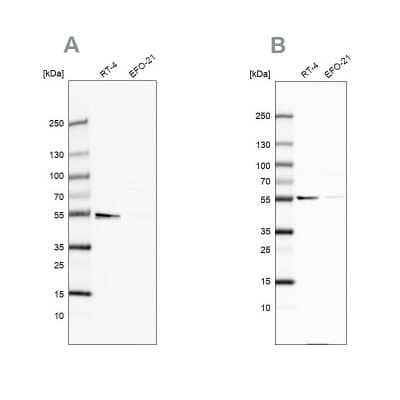 Western Blot: ATP5A Antibody [NBP2-38470] - Analysis using Anti-ATP5A1 antibody NBP2-38470 (A) shows similar pattern to independent antibody NBP2-38525 (B).