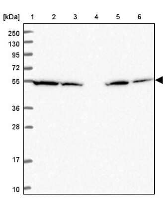 Western Blot: ATP5A Antibody [NBP2-38525] - Lane 1: Marker  [kDa] 250, 130, 95, 72, 55, 36, 28, 17, 10.  Lane 2: Human cell line RT-4.  Lane 3: Human cell line U-251MG.  Lane 4: Human Plasma.  Lane 5: Human liver tissue.  Lane 6: Human tonsil tissue