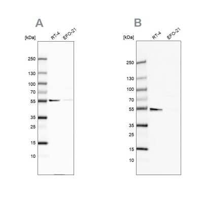 Western Blot: ATP5A Antibody [NBP2-38525] - Analysis using Anti-ATP5A1 antibody NBP2-38525 (A) shows similar pattern to independent antibody NBP2-38470 (B).