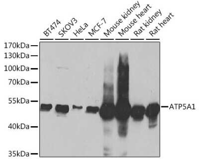 Western Blot: ATP5A Antibody [NBP2-92928] - Analysis of extracts of various cell lines, using ATP5A at 1:1000 dilution.Secondary antibody: HRP Goat Anti-Rabbit IgG (H+L) at 1:10000 dilution.Lysates/proteins: 25ug per lane.Blocking buffer: 3% nonfat dry milk in TBST.Detection: ECL Basic Kit .Exposure time: 1s.