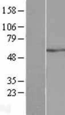 Western Blot: ATP5A Overexpression Lysate (Adult Normal) [NBL1-07816] Left-Empty vector transfected control cell lysate (HEK293 cell lysate); Right -Over-expression Lysate for ATP5A.