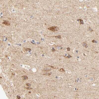 Immunohistochemistry-Paraffin ATP5D Antibody - BSA Free