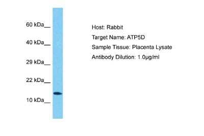 Western Blot: ATP5D Antibody [NBP2-84480] - Host: Rabbit. Target Name: ATP5D. Sample Type: Placenta lysates. Antibody Dilution: 1.0ug/ml