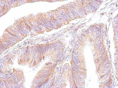 Immunohistochemistry-Paraffin: ATP5F1 Antibody [NBP1-33465] - Paraffin-embedded colon; antibody dilution 1:500.