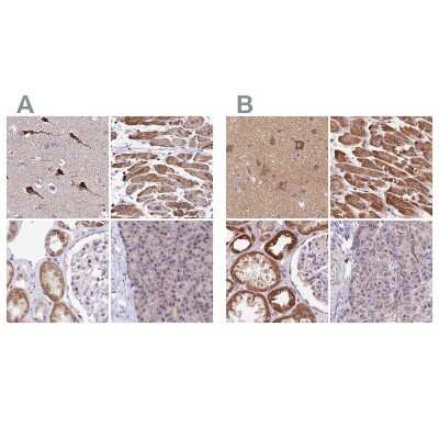 <b>Independent Antibodies Validation and Orthogonal Strategies Validation.</b>Immunohistochemistry-Paraffin: ATP5F1 Antibody [NBP1-91689] - Staining of human cerebral cortex, heart muscle, kidney and pancreas using Anti-ATP5F1 antibody NBP1-91689 (A) shows similar protein distribution across tissues to independent antibody NBP2-49255 (B).