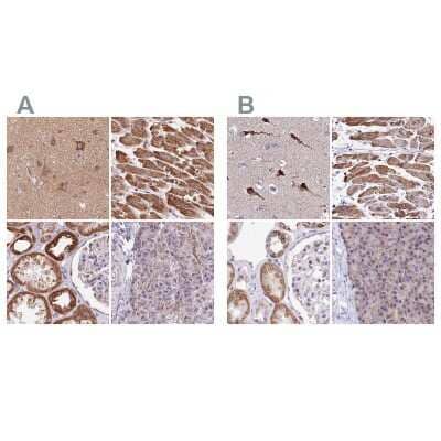 <b>Independent Antibodies Validation. </b>Immunohistochemistry-Paraffin: ATP5F1 Antibody [NBP2-49255] - Staining of human cerebral cortex, heart muscle, kidney and pancreas using Anti-ATP5F1 antibody NBP2-49255 (A) shows similar protein distribution across tissues to independent antibody NBP1-91689 (B).