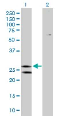 Western Blot: ATP5F1 Antibody [H00000515-B02P] - Analysis of ATP5F1 expression in transfected 293T cell line by ATP5F1 polyclonal antibody.  Lane 1: ATP5F1 transfected lysate(28.16 KDa). Lane 2: Non-transfected lysate.