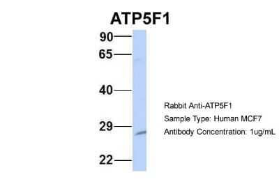 Western Blot: ATP5F1 Antibody [NBP1-54702] - Sample Type: MCF7 Antibody Dilution: 1.0 ug/ml ATP5F1 is supported by BioGPS gene expression data to be expressed in MCF7