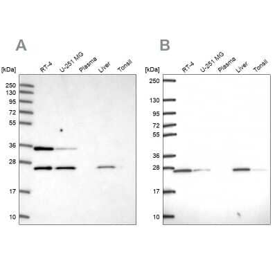 <b>Independent Antibodies Validation. </b>Western Blot: ATP5F1 Antibody [NBP1-91689] - Analysis using Anti-ATP5F1 antibody NBP1-91689 (A) shows similar pattern to independent antibody NBP2-49255 (B).