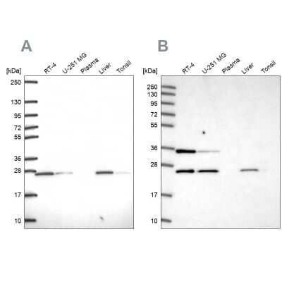 Western Blot: ATP5F1 Antibody [NBP2-49255] - Analysis using Anti-ATP5F1 antibody NBP2-49255 (A) shows similar pattern to independent antibody NBP1-91689 (B).