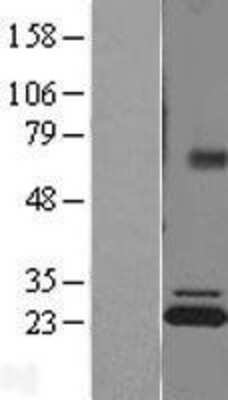 Western Blot: ATP5F1 Overexpression Lysate (Adult Normal) [NBL1-07822] - Western Blot experiments.  Left-Control; Right -Over-expression Lysate for ATP5F1