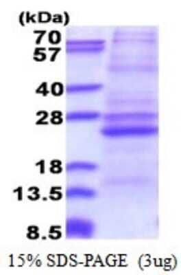 SDS-Page: ATP5F1 Recombinant Protein [NBP2-51532] - 15% SDS Page (3 ug)