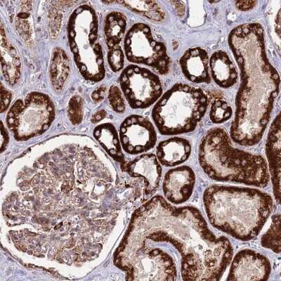 Immunohistochemistry: ATP5H Antibody [NBP2-48906] - Staining of human kidney shows strong granular cytoplasmic positivity in cells in tubules.