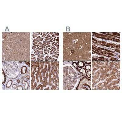 <b>Independent Antibodies Validation. </b>Immunohistochemistry-Paraffin: ATP5H Antibody [NBP2-47545] - Staining of human cerebral cortex, heart muscle, kidney and liver using Anti-ATP5H antibody NBP2-47545 (A) shows similar protein distribution across tissues to independent antibody NBP2-48906 (B).