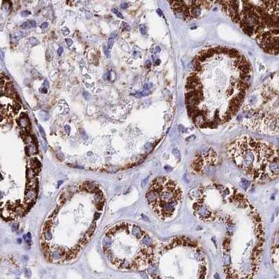 Immunohistochemistry-Paraffin: ATP5H Antibody [NBP2-47545] - Staining of human kidney.