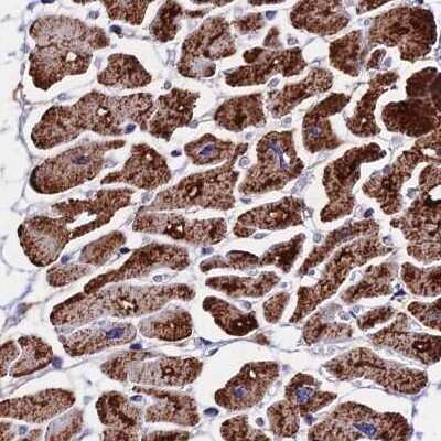 Immunohistochemistry-Paraffin: ATP5H Antibody [NBP2-47545] - Staining of human heart muscle.
