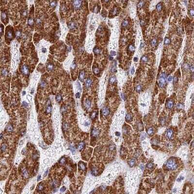 Immunohistochemistry-Paraffin: ATP5H Antibody [NBP2-47545] - Staining of human liver.