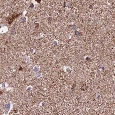 Immunohistochemistry-Paraffin: ATP5H Antibody [NBP2-47545] - Staining of human cerebral cortex.
