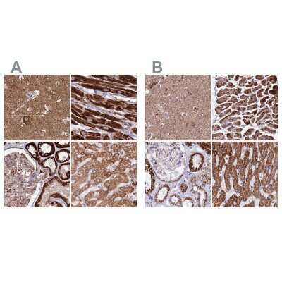 <b>Independent Antibodies Validation. </b>Immunohistochemistry-Paraffin: ATP5H Antibody [NBP2-48906] - Staining of human cerebral cortex, heart muscle, kidney and liver using Anti-ATP5H antibody NBP2-48906 (A) shows similar protein distribution across tissues to independent antibody NBP2-47545 (B).