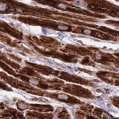 Immunohistochemistry-Paraffin: ATP5H Antibody [NBP2-48906] - Staining of human heart muscle.