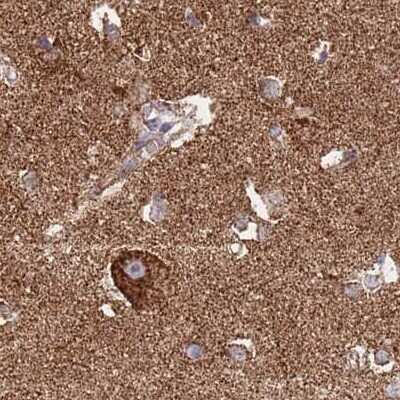 Immunohistochemistry-Paraffin: ATP5H Antibody [NBP2-48906] - Staining of human cerebral cortex.