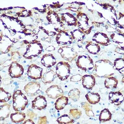 Immunohistochemistry-Paraffin: ATP5H Antibody [NBP2-92443] - Immunohistochemistry of paraffin-embedded rat kidney using ATP5H Rabbit pAb (NBP2-92443) at dilution of 1:100 (40x lens). Perform microwave antigen retrieval with 10 mM Tris/EDTA buffer pH 9.0 before commencing with IHC staining protocol.