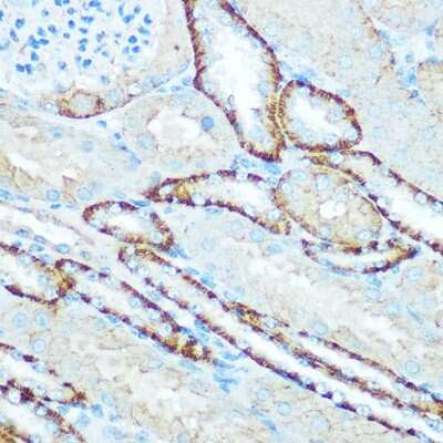 Immunohistochemistry-Paraffin: ATP5H Antibody [NBP2-92443] - Immunohistochemistry of paraffin-embedded mouse kidney using ATP5H Rabbit pAb (NBP2-92443) at dilution of 1:100 (40x lens). Perform microwave antigen retrieval with 10 mM Tris/EDTA buffer pH 9.0 before commencing with IHC staining protocol.