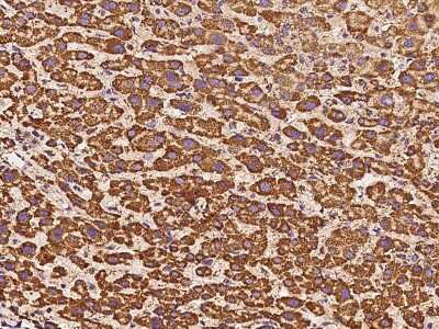Immunohistochemistry-Paraffin: ATP5H Antibody [NBP2-97512] - Immunochemical staining of human ATP5H in human liver with rabbit polyclonal antibody at 1:200 dilution, formalin-fixed paraffin embedded sections.
