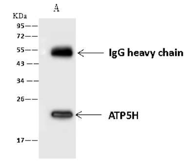 Immunoprecipitation: ATP5H Antibody [NBP2-97512] - ATP5H was immunoprecipitated using: Lane A: 0.5 mg PC-3 Whole Cell Lysate. 4 ul anti-ATP5H rabbit polyclonal antibody and 60 ug of Immunomagnetic beads. Protein A/G. Primary antibody: Anti-ATP5H rabbit polyclonal antibody, at 1:100 dilution. Secondary antibody: Goat Anti-Rabbit IgG (H+L)/HRP at 1/10000 dilution. Developed using the ECL technique. Performed under reducing conditions. Predicted band size: 18 kDa. Observed band size: 22 kDa