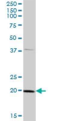 Western Blot: ATP5H Antibody [H00010476-B01P] - ATP5H MaxPab polyclonal antibody. Western Blot analysis of ATP5H expression in human liver.
