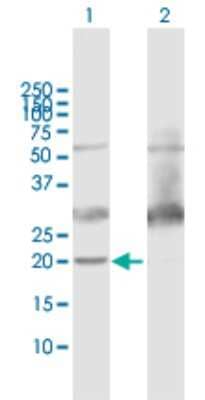 Western Blot: ATP5H Antibody [H00010476-B01P] - Analysis of ATP5H expression in transfected 293T cell line by ATP5H polyclonal antibody.  Lane 1: ATP5H transfected lysate(17.71 KDa). Lane 2: Non-transfected lysate.