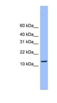 Western Blot: ATP5H Antibody [NBP1-79479] - MCF-7 whole cell lysates, concentration 0.2-1 ug/ml.