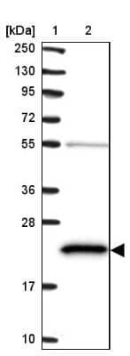 Western Blot: ATP5H Antibody [NBP2-48906] - Lane 1: Marker [kDa] 250, 130, 95, 72, 55, 36, 28, 17, 10Lane 2: Human cell line RT-4
