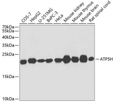 Western Blot: ATP5H Antibody [NBP2-92443] - Analysis of extracts of various cell lines, using ATP5H at 1:1000 dilution.Secondary antibody: HRP Goat Anti-Rabbit IgG (H+L) at 1:10000 dilution.Lysates/proteins: 25ug per lane.Blocking buffer: 3% nonfat dry milk in TBST.Detection: ECL Basic Kit .Exposure time: 60s.