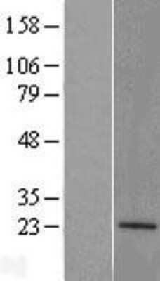 Western Blot: ATP5H Overexpression Lysate (Adult Normal) [NBL1-07824] Left-Empty vector transfected control cell lysate (HEK293 cell lysate); Right -Over-expression Lysate for ATP5H.