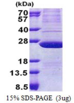 SDS-Page: ATP5H Protein [NBP2-22700]