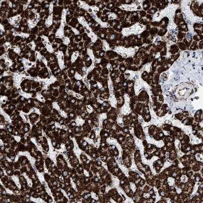 Immunohistochemistry-Paraffin: ATP5J Antibody [NBP1-88888] - Staining of human liver shows strong cytoplasmic positivity in hepatocytes.