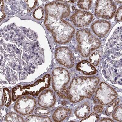 Immunohistochemistry-Paraffin: ATP5J2 Antibody [NBP2-57465] - Staining of human kidney shows strong cytoplasmic positivity with a granular pattern in cells in tubules.