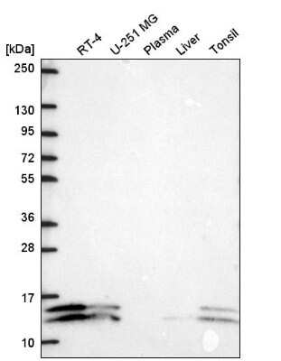 Western Blot: ATP5J2 Antibody [NBP2-57465] - Analysis in human cell line RT-4, human cell line U-251 MG, human plasma, human liver tissue and human tonsil tissue.