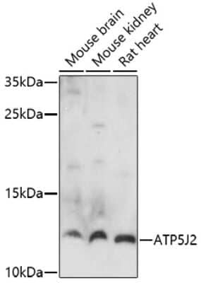 Western Blot: ATP5J2 Antibody [NBP2-92345] - Analysis of extracts of various cell lines, using ATP5J2 at 1:1000 dilution.Secondary antibody: HRP Goat Anti-Rabbit IgG (H+L) at 1:10000 dilution.Lysates/proteins: 25ug per lane.Blocking buffer: 3% nonfat dry milk in TBST.Detection: ECL Basic Kit .Exposure time: 90s.