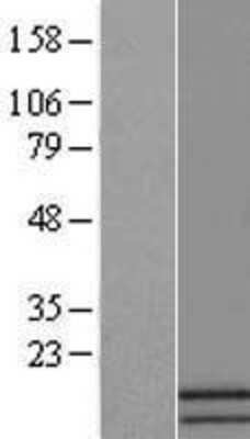 Western Blot: ATP5J2 Overexpression Lysate (Adult Normal) [NBL1-07827] Left-Empty vector transfected control cell lysate (HEK293 cell lysate); Right -Over-expression Lysate for ATP5J2.