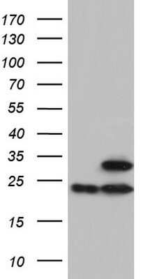 Western Blot: ATP5O Antibody (OTI2E9) - Azide and BSA Free [NBP2-70239] - Analysis of HEK293T cells were transfected with the pCMV6-ENTRY control (Left lane) or pCMV6-ENTRY ATP5O.