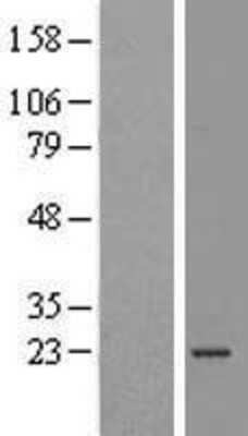 Western Blot: ATP5O Overexpression Lysate (Adult Normal) [NBL1-07829] Left-Empty vector transfected control cell lysate (HEK293 cell lysate); Right -Over-expression Lysate for ATP5O.