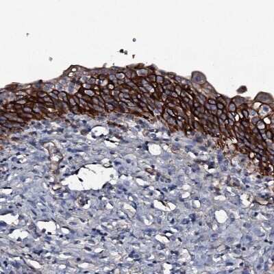 Immunohistochemistry-Paraffin: ATP5SL Antibody [NBP2-14509] - Staining of human urinary bladder shows strong cytoplasmic and membranous positivity in urothelial cells.