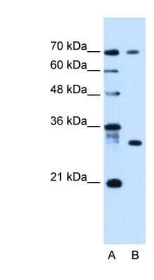 Western Blot ATP6AP1L Antibody - BSA Free