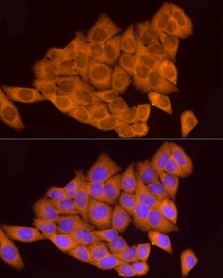 Immunocytochemistry/Immunofluorescence: ATP6V0A1 Antibody [NBP2-92219] - Immunofluorescence analysis of HeLa cells using ATP6V0A1 antibody (NBP2-92219) at dilution of 1:100. Blue: DAPI for nuclear staining.